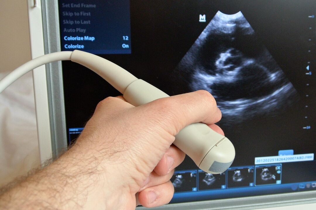 Ultrazvok bo pomagal diagnosticirati kongestivni prostatitis pri moškem