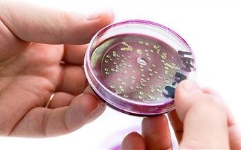 Bakterije v izločku prostate